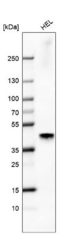 SF-1/NR5A1/Steroidogenic Factor 1 Antibody (CL9101), Novus Biologicals